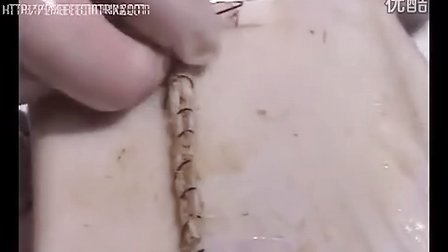 英国广播公司承认，在未能质疑哈里王子“缝合”的说法后，其编辑标准出现了失误