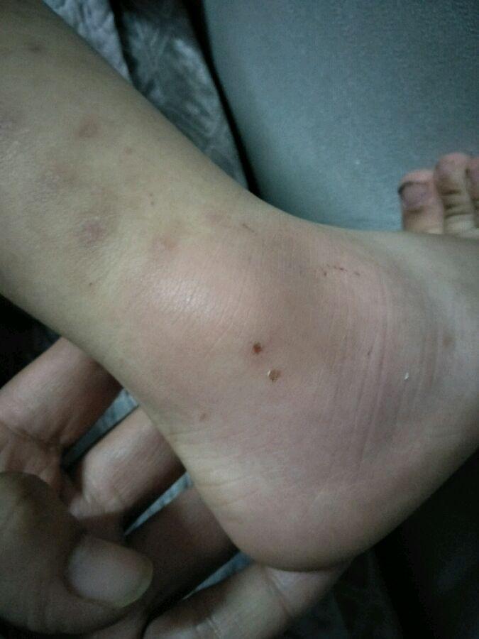 突发新闻：五人在深夜派对后在Plumstead被刺，并被紧急送往医院